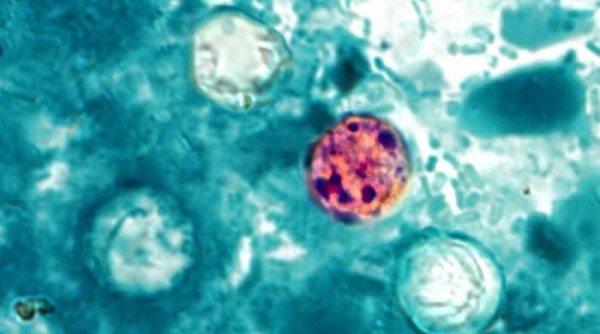Cyclosporiasis pictured by CDC